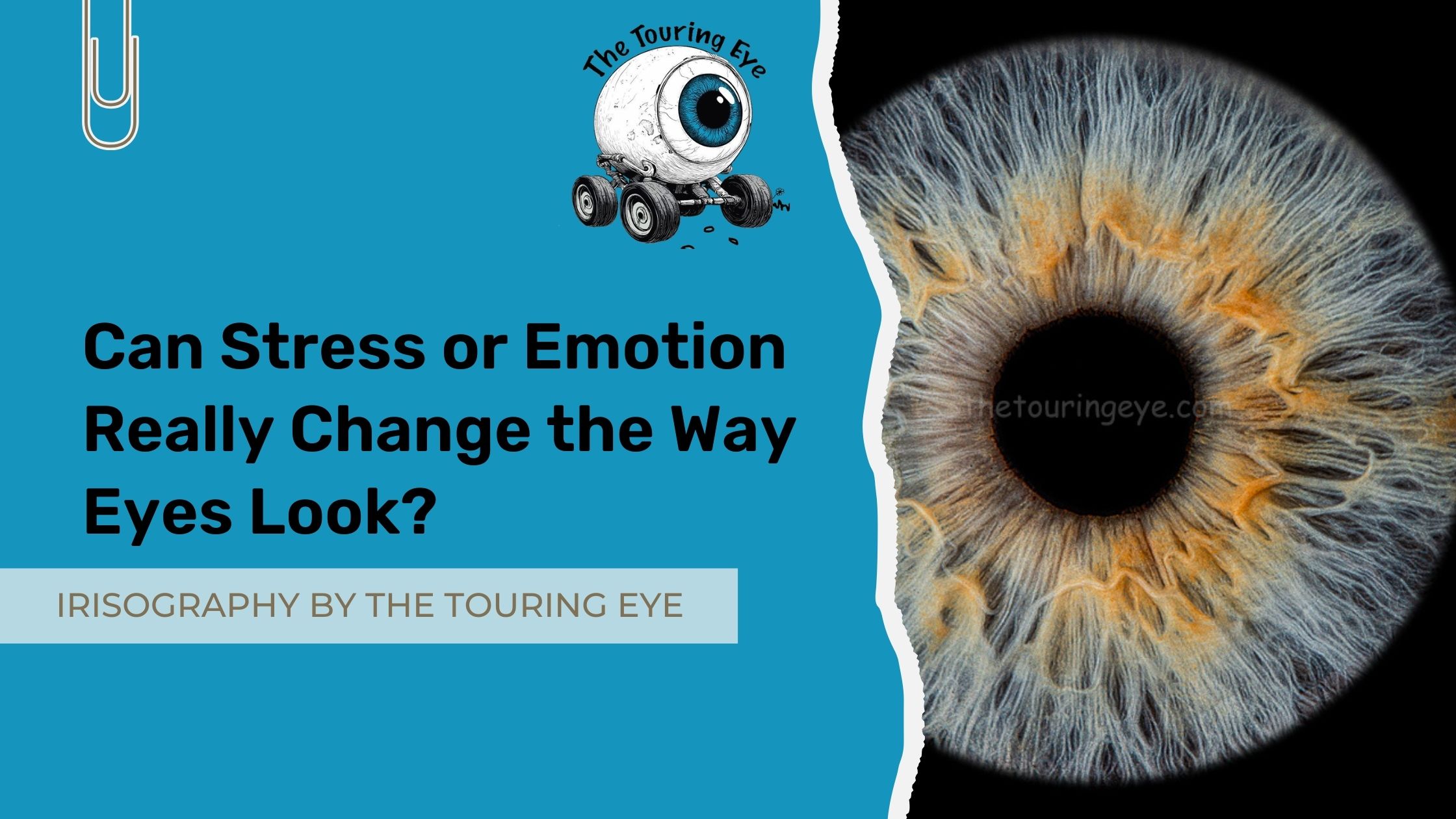 Can Stress or Emotion Really Change the Way Eyes Look?
